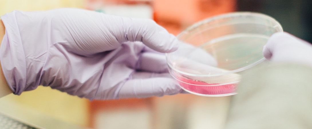 petri dish