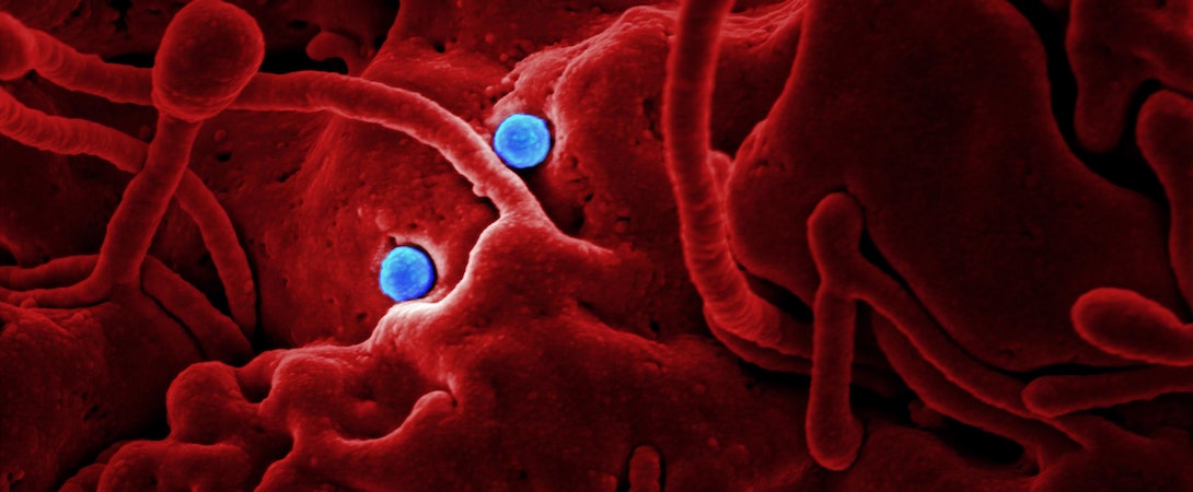 virus under a microscope